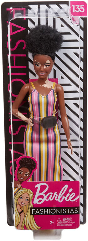 Poupée Barbie Fashionistas 135 avec vitiligo
