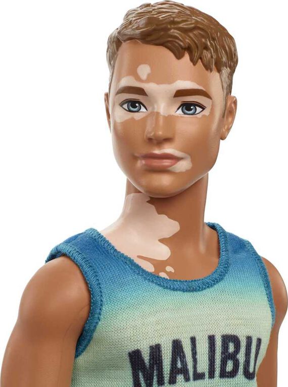 Barbie- Ken- Fashionistas- Poupée 192, vitiligo