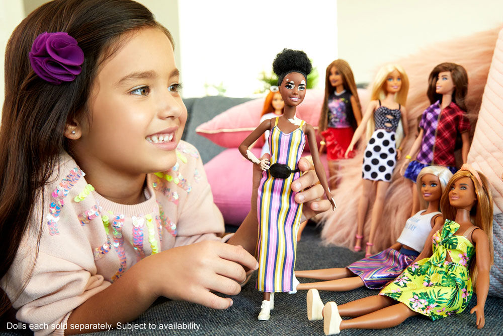 Barbie Fashionistas Doll 135 with Vitiligo Toys R Us Canada